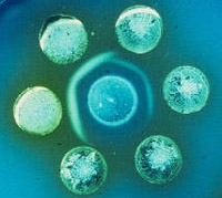 Immunodif