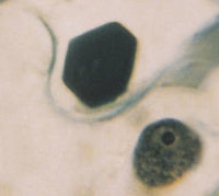 TMV