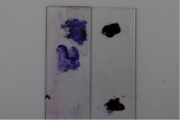 UndesiredCytologicalSpecimen