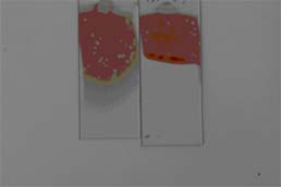 ThickBloodFilm
